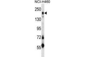 Western blot analysis in NCI-H460 cell line lysates (35ug/lane) using CD280 / MRC2 Antibody . (MRC2 antibody  (Middle Region))