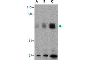 Western blot analysis of MAPKAP1 in human skeletal muscle tissue lysate with MAPKAP1 polyclonal antibody  at (A) 0. (MAPKAP1 antibody  (N-Term))