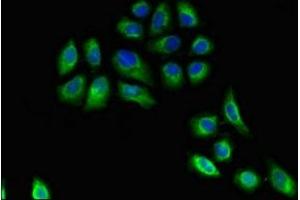 Immunofluorescent analysis of A549 cells using ABIN7155605 at dilution of 1:100 and Alexa Fluor 488-congugated AffiniPure Goat Anti-Rabbit IgG(H+L) (HLA-DRB3 antibody  (AA 111-227))