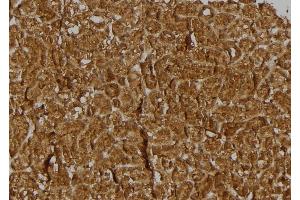 ABIN6274930 at 1/100 staining Rat kidney tissue by IHC-P. (BRWD3 antibody  (C-Term))