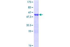 Image no. 1 for YY1 Associated Factor 2 (YAF2) (AA 1-180) protein (GST tag) (ABIN1325493) (YAF2 Protein (AA 1-180) (GST tag))