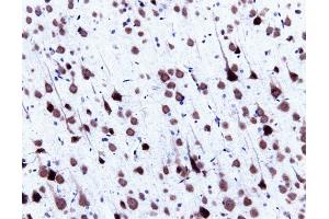 Immunohistochemical staining of pyrimidal cells in a rat cortex, formalin-fixed paraffin-embedded tissue section, with citrate pre-treatment (magnification, 20X) (center). (SNRPN antibody  (AA 14-174))