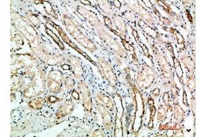 Immunohistochemical analysis of paraffin-embedded human-kidney, antibody was diluted at 1:200 (ART4 antibody  (AA 181-230))
