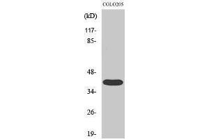 Western Blotting (WB) image for anti-Mitogen-Activated Protein Kinase-Activated Protein Kinase 3 (MAPKAPK3) (C-Term) antibody (ABIN3173584) (MAPKAP Kinase 3 antibody  (C-Term))
