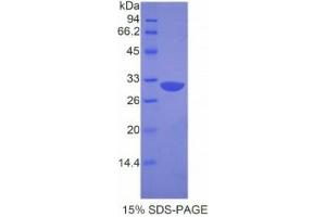 SDS-PAGE analysis of Mouse APAF1 Protein. (APAF1 Protein)