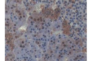 DAB staining on IHC-P; Samples: Rat Adrenal gland Tissue (PLSCR4 antibody  (AA 1-299))