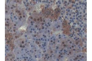 DAB staining on IHC-P; Samples: Rat Adrenal gland Tissue