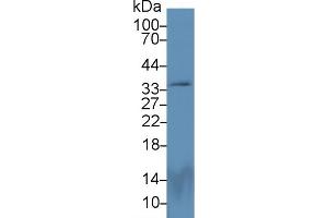Detection of PEX2 in Rat Cerebrum lysate using Polyclonal Antibody to Peroxisomal Biogenesis Factor 2 (PEX2) (PEX2 antibody  (AA 233-305))