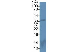 Detection of PEX2 in Rat Cerebrum lysate using Polyclonal Antibody to Peroxisomal Biogenesis Factor 2 (PEX2) (PEX2 antibody  (AA 233-305))