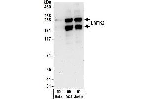 anti-Lemur tyrosine Kinase 2 (LMTK2) (AA 675-725) antibody