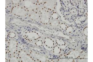 Immunostaining (ISt) image for anti-Splicing Factor 3b, Subunit 2, 145kDa (SF3B2) (AA 592-645) antibody (ABIN564766)