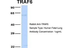 Host: Rabbit Target Name: TRAF6 Sample Type: Human Fetal Lung Antibody Dilution: 1. (TRAF6 antibody  (Middle Region))