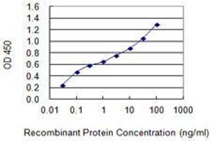 Detection limit for recombinant GST tagged HNF1A is 0. (HNF1A antibody  (AA 532-631))