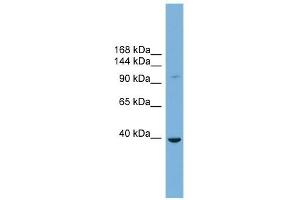 ST14 antibody used at 1 ug/ml to detect target protein. (ST14 antibody)