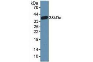 Detection of Recombinant CARD9, Mouse using Polyclonal Antibody to Caspase Recruitment Domain Family, Member 9 (CARD9) (CARD9 antibody  (AA 274-530))