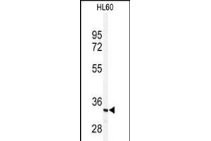 Western blot analysis of anti-PRKRA Antibody  (ABIN392151 and ABIN2841876) in HL60 cell line lysates (35 μg/lane). (PRKRA antibody  (AA 225-252))