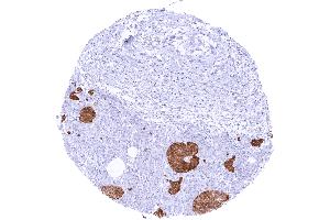 Strong cytoplasmic GAD2 staining of pancreatic islet cells (GAD65 antibody  (AA 6-99))