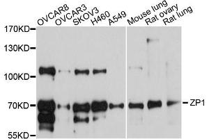 Western blot analysis of extracts of various cell lines, using ZP1 antibody (ABIN5999216) at 1/1000 dilution. (ZP1 antibody)