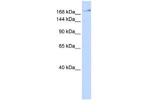WB Suggested Anti-ZMYM4 Antibody Titration:  0. (ZMYM4 antibody  (N-Term))