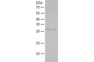 Western Blotting (WB) image for alpha-Methylacyl-CoA Racemase (AMACR) (AA 171-382) protein (His tag) (ABIN7283157) (AMACR Protein (AA 171-382) (His tag))