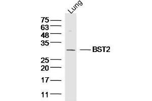 Mouse lung lysates probed with BST2/CD317 Polyclonal Antibody, unconjugated  at 1:300 overnight at 4°C followed by a conjugated secondary antibody at 1:10000 for 90 minutes at 37°C.