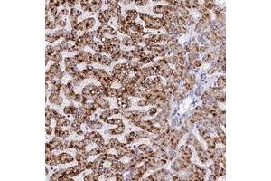 Immunohistochemical staining of human liver with SPINK9 polyclonal antibody  shows strong cytoplasmic positivity in hepatocytes at 1:20-1:50 dilution.