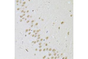 Immunohistochemistry (Paraffin-embedded Sections) (IHC (p)) image for anti-Small Nuclear Ribonucleoprotein Polypeptide A (SNRPA) (AA 1-282) antibody (ABIN6148210)
