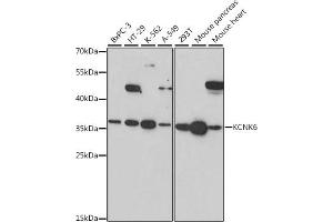 Western blot analysis of extracts of various cell lines, using KCNK6 antibody (ABIN7269467) at 1:1000 dilution. (KCNK6 antibody  (AA 254-313))