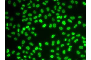 Immunofluorescence (IF) image for anti-Hepatoma-Derived Growth Factor (HDGF) antibody (ABIN1876535) (HDGF antibody)