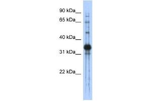 Chondroadherin antibody used at 1 ug/ml to detect target protein. (CHAD antibody  (Middle Region))
