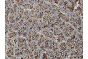 Image no. 1 for anti-Elastase 3A (ELA3A) (AA 16-271) antibody (ABIN599118) (Elastase 3A antibody  (AA 16-271))