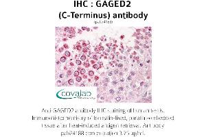 Image no. 2 for anti-X Antigen Family, Member 1B (XAGE1B) (C-Term) antibody (ABIN1734558)