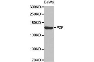 Western blot analysis of extracts of BeWo cell line, using PZP antibody. (PZP antibody  (AA 620-740))