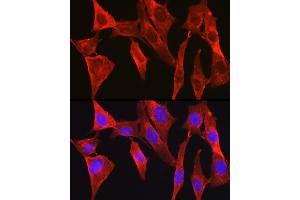 Immunofluorescence analysis of NIH/3T3 cells using D Rabbit pAb (ABIN6134076, ABIN6139403, ABIN6139404 and ABIN6224222) at dilution of 1:250 (40x lens).