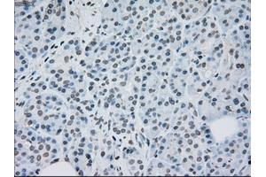 Immunohistochemical staining of paraffin-embedded lung tissue using anti-MAP2K2mouse monoclonal antibody. (MEK2 antibody)