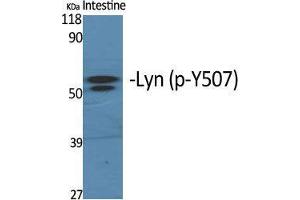 Western Blot (WB) analysis of specific cells using Phospho-Lyn (Y508) Polyclonal Antibody. (LYN antibody  (pTyr508))