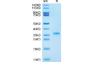 SARS-CoV-2 3CLpro (P132H) on Tris-Bis PAGE under reduced condition. (SARS-Coronavirus Nonstructural Protein 8 (SARS-CoV NSP8) (P132H) Protein)