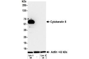 Western Blotting (WB) image for anti-Keratin 6 (KRT6) (C-Term) antibody (ABIN7795792) (Recombinant Keratin 6 antibody  (C-Term))