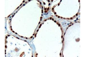 PAX8 polyclonal antibody  staining (3 ug/mL) of paraffin embedded human thyroid gland. (PAX8 antibody)