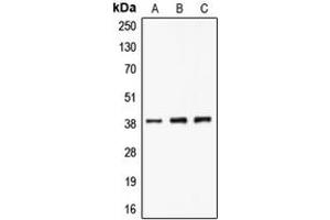 Western blot analysis of CLNS1A expression in A549 (A), K562 (B), Jurkat (C) whole cell lysates. (CLNS1A antibody  (C-Term))
