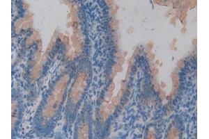 IHC-P analysis of Rat Intestine Tissue, with DAB staining. (KRT20 antibody  (AA 75-382))