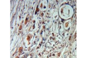 Used in DAB staining on fromalin fixed paraffin-embedded Pancreas tissue (Cholecystokinin antibody)