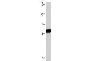 Western Blotting (WB) image for anti-Protein Phosphatase 3, Catalytic Subunit, alpha Isoform (PPP3CA) antibody (ABIN2429663) (PPP3CA antibody)