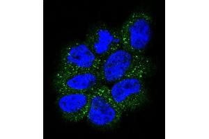 Confocal immunofluorescent analysis of NRAS Antibody (N-term) (ABIN392152 and ABIN2841877) with NCI- cell followed by Alexa Fluor 488-conjugated goat anti-rabbit lgG (green). (GTPase NRas antibody  (N-Term))