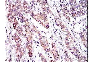Immunohistochemistry (IHC) image for anti-ATP-Binding Cassette, Sub-Family C (CFTR/MRP), Member 4 (ABCC4) (AA 631-692) antibody (ABIN1845663) (ABCC4 antibody  (AA 631-692))