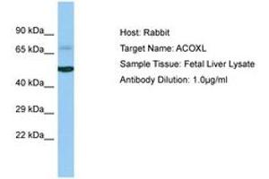 Image no. 1 for anti-Acyl-CoA Oxidase-Like (ACOXL) (AA 263-312) antibody (ABIN6750230) (ACOXL antibody  (AA 263-312))