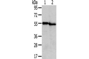 Gel: 8 % SDS-PAGE,Lysate: 40 μg,Lane 1-2: Human normal liver tissue, Human kidney tissue,Primary antibody: ABIN7131406(TMPRSS5 Antibody) at dilution 1/300 dilution,Secondary antibody: Goat anti rabbit IgG at 1/8000 dilution,Exposure time: 5 minutes (TMPRSS5 antibody)