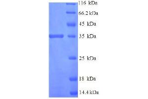 TMX3 Protein (AA 25-195, Isoform 2) (His-SUMO Tag)