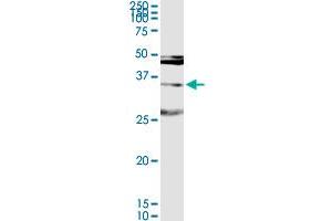 MAGEA9 MaxPab rabbit polyclonal antibody. (MAGEA9 antibody  (AA 1-315))