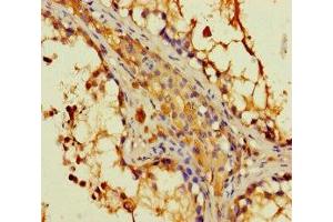 Immunohistochemistry of paraffin-embedded human testis tissue using ABIN7149562 at dilution of 1:100 (DAPL1 antibody  (AA 1-107))